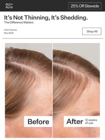 No Thumbnail Set